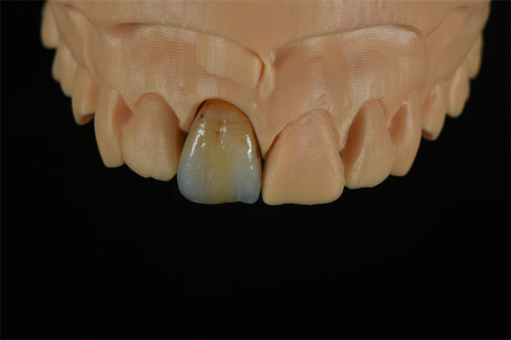 jakość  Affordable Zirconia Crowns with Custom Color Staining - China Dental Lab fabryka
